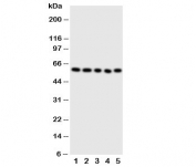 Western blot testing of ERp57 antibody and Lane 1:  SMMC-7721;  2: A549;  3: U87;  4: HeLa;  5: MCF-7 cell lysate. Predicted molecular weight: ~57-60kDa.