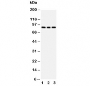 Western blot testing of PI3K antibody and Lane 1:  rat testis;  2: 293T;  3: HeLa cell lysate. Predicted molecular weight ~85 kDa.