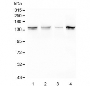 Western blot testing of 1) rat brain, 2) rat C6, 3) mouse liver and 4) mouse NIH3T3 lysate with Myosin Phosphatase antibody.  Expected molecular weight: 110~130 kDa.