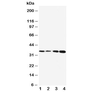 Western blot testing of Protein C antibody and Lane 1: Jurkat; 2: CEM; 3: SMMC-7721; 4: HeLa cell lysate. Observed size: 35KD, predicted size: 52KD~