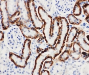 IHC-P: SLC22A6 antibody testing of rat kidney tissue