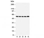 Western blot testing of NK1R antibody and Lane 1:  A549;  2: U87;  3: COLO320;  4: SCG;  5: PANC cell lysate