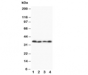Western blot testing of Stra8 antibody and Lane 1:  A231;  2: Jurkat;  3: HT1080;  4: SCG cell lysate.  Predicted size: ~37KD