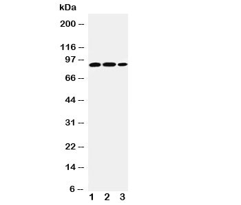 Western blot testing of STAT4 antibody and Lane 1: rat testis; 2: human U87; 3: (h) HeLa cell lysate