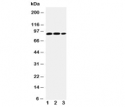 Western blot testing of STAT4 antibody and Lane 1:  rat testis;  2: human U87;  3: (h) HeLa cell lysate. Predicted molecular weight: ~86kDa.