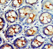 IHC testing of FFPE rat intestine tissue with SSTR1 antibody at 1ug/ml. HIER: steam section in pH6 citrate buffer for 20 min and allow to cool prior to testing.