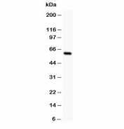 Western blot testing of SSTR1 antibody and rat intestine lysate;  The protein is routinely visualized from 42~80 kDa due to glycosylation.