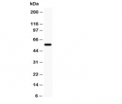 Western blot testing of SSTR2 antibody and rat lung lysate.  The protein is routinely visualized from 41~80KD, due to glycosylation.