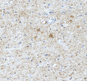 IHC staining of FFPE human brain tissue with TNR antibody, HRP-secondary and DAB substrate. HIER: boil tissue sections in pH8 EDTA for 20 min and allow to cool before testing.