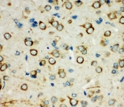 IHC-P: XRCC3 antibody testing of rat brain tissue. HIER: steamed with pH6 citrate buffer.