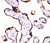 IHC-P: CYP11A1 antibody testing of human placenta tissue