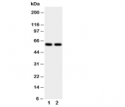 Western blot testing of CYP11A1 antibody and human placenta tissue lysate.  Expected molecular weight: 50-60 kDa.