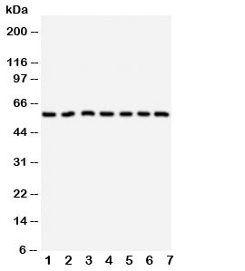 Western blot testing of CYP11B1 antibody and Lane 1: HeLa; 2: U87; 3: MM231; 4: PANC; 5: MM453; 6: HeLa; 7: SMMC-7721 cell lysate. Predicted size: 58KD