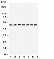Western blot testing of CYP11B1 antibody and Lane 1:  HeLa;  2: U87;  3: MM231;  4: PANC;  5: MM453;  6: HeLa;  7: SMMC-7721 cell lysate.  Predicted size: 58KD