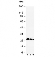 Western blot testing of IL-6 antibody and recombinant human protein: (1) 10ng, (2) 5ng, (3) 2.5ng