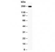 Western blot testing of Integrin beta 4 antibody and A431 lysate;  Predicted molecular weight ~200 kDa.