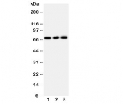Western blot testing of SERT antibody and Lane 1:  U87;  2: HeLa;  3: Jurkat cell lysate. Expected molecular weight: ~70/85-95kDa (unmodified/glycosylated).