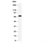 Western blot testing of Serotonin transporter antibody and rat brain tissue lysate. Expected molecular weight: ~70/85-95kDa (unmodified/glycosylated).