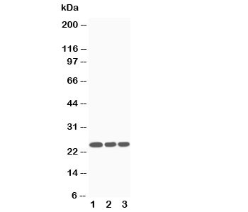 Western blot testing of SOCS3 antibody and Lane 1: Jurkat; 2: CEM; 3: Raji cell lysate