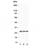 Western blot testing of SOCS3 antibody and Lane 1:  Jurkat;  2: CEM;  3: Raji cell lysate. Predicted molecular weight ~24kDa.