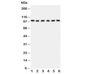 Western blot testing of MCM2 antibody and Lane 1:  rat testis;  2: (r) kidney;  3: mouse intestine;  4: (m) testis;  5: (m) ovary;  6: (m) kidney