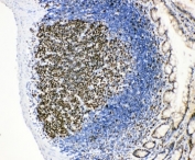 IHC-P: MCM2 antibody testing of rat intestinal lymphocyte tissue