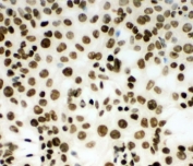 ICC testing of (m) HEPA cells