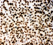 ICC testing of (m) NIH3T3 cells