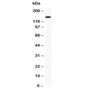 Western blot testing of P-Selectin antibody and PANC lysate;  The protein is visualized from 86~140 kDa due to glycosylation.