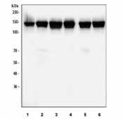 Western blot testing of human 1) 293T, 2) HeLa, 3) HepG2, 4) Raji, 5) K562 and 6) Caco-2 cell lysate with RFC1 antibody. Predicted molecular weight ~128 kDa.
