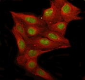 Immunofluorescent staining of FFPE human U-2 OS cells with RFC1 antibody (green) and Beta Tubulin mAb (red). HIER: steam section in pH6 citrate buffer for 20 min.