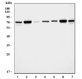 Western blot testing of 1) rat brain, 2) rat kidney, 3) rat spleen, 4) rat liver, 5) mouse brain, 6) mouse kidney and 7) mouse liver tissue lysate with SDHA antibody.  Predicted molecular weight ~73 kDa.~