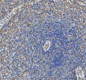IHC staining of FFPE human spleen tissue with SDHA antibody. HIER: boil tissue sections in pH8 EDTA for 20 min and allow to cool before testing.