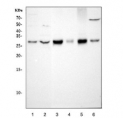 Western blot testing of 1) human 293T, 2) human HepG2, 3) rat heart, 4) rat brain, 5) mouse heart and 6) mouse brain tissue lysate with SDHB antibody. Predicted molecular weight ~32 kDa.