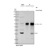 Immunoprecipitation of SDHB protein from 500ug of human HepG2 whole cell lysate with 2ug of SDHB antibody.