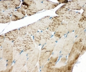 IHC-P: SERCA1 ATPase antibody testing of rat skeletal muscle tissue