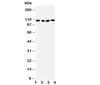 Western blot testing of SERCA2 ATPase antibody and Lane 1: rat skeletal muscle; 2: rat kidney; 3: human PANC; 4: SMMC-7721 cell lysate. Predicted size: 115KD~