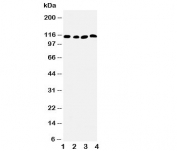 Western blot testing of SERCA2 ATPase antibody and Lane 1:  rat skeletal muscle;  2: rat kidney;  3: human PANC;  4: SMMC-7721 cell lysate.  Predicted size: 115KD