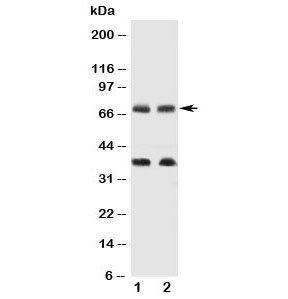 Western blot testing of GAT-1 antibody and Lane 1: rat brain; 2: mouse brain tissue lysate. Predicted size: 67~80 depending on level of glycosylation. The ~35KD band in uncharacterized.~