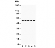 Western blot testing of GLUT4 antibody and Lane 1:  rat heart;  2: rat skeletal muscle;  3: mouse heart;  4: mouse skeletal muscle;  5: human HeLa lysate. Predicted molecular weight: 45-55kDa.