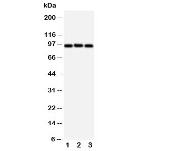 Western blot testing of ABCB6 antibody and Lane 1: HeLa; 2: MCF-7; 3: A549 cell lysate. Predicted size: 94KD.~