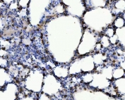 IHC testing of FFPE mouse lung tissue with COX-2 antibody. HIER: boil tissue sections in pH8 EDTA for 20 min and allow to cool before testing.