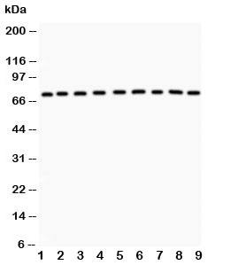 Western blot testing of GHR antibody and Lane 1: rat liver; 2: (r) kidney; 3: (r) spleen; 4: (r) intestine; 5: mouse spleen; 6: (m) testis; 7: (m) liver; 8: (m) kidney; 9: (m) intestine; Predicted size: 72KD