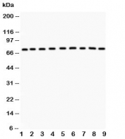 Western blot testing of GHR antibody and Lane 1:  rat liver;  2: (r) kidney;  3: (r) spleen;  4: (r) intestine;  5: mouse spleen;  6: (m) testis;  7: (m) liver;  8: (m) kidney;  9: (m) intestine. Predicted molecular weight ~72 kDa but GHR can be glycosylated, ubiquitinated and complex with GH causing a larger than predicted size to be observed.