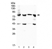 Western blot testing of 17-beta-Hydroxysteroid dehydrogenase 4 antibody and Lane 1:  mouse heart;  2: rat heart;  3: human placenta 4: human MCF7 lysate. Predicted molecular weight ~80 kDa.