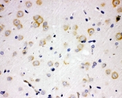 IHC-P: PAK6 antibody testing of rat brain tissue