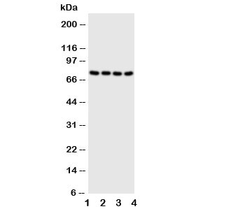 Western blot testing of PAK6 antibody and Lane 1: HeLa; 2: 293T; 3: Raji; 4: COLO320 cell lysate~