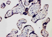 IHC staining of FFPE human placental tissue with TLR7 antibody. HIER: boil tissue sections in pH6 citrate buffer for 20 min and allow to cool before testing.