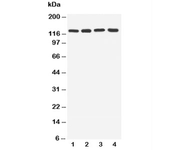 Western blot testing of TLR7 antibody and Lane 1: rat spleen; 2: rat liver; 3: U87; 4: A549 cell lysate