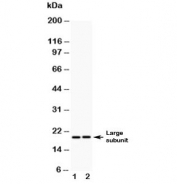 Western blot testing of Caspase-8 antibody (0.5ug/ml) and Lane 1:  human A549;  2: (h) HeLa lysate. Predicted molecular weight: ~55 kDa (pro), ~40 kDa (large + small subunit), ~20 kDa (large subunit).
